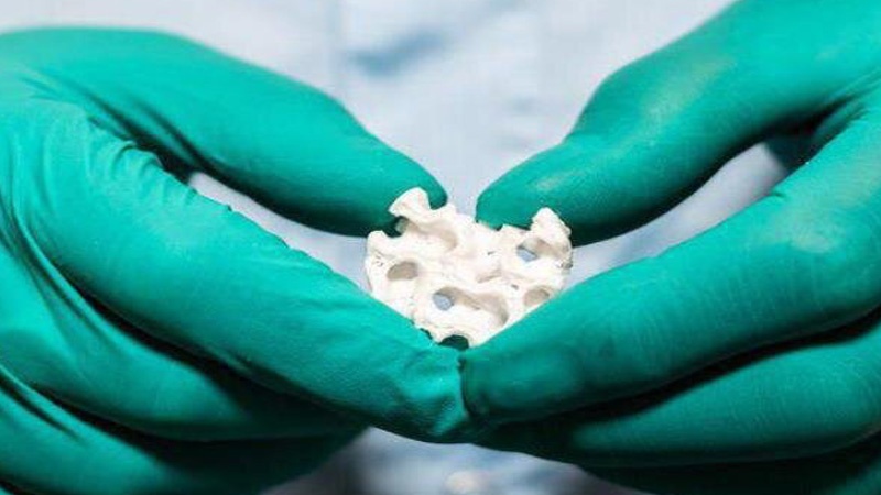 Iranpress: First Iranian artificial bone unveiled