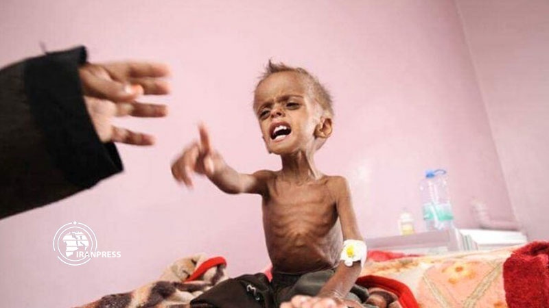 Iranpress: 100,000 Yemeni children die of Saudi-led war a year: Health minister