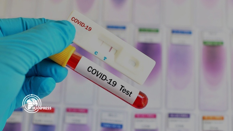 Iranpress: Iranian made coronavirus diagnostic test kits to go to global market