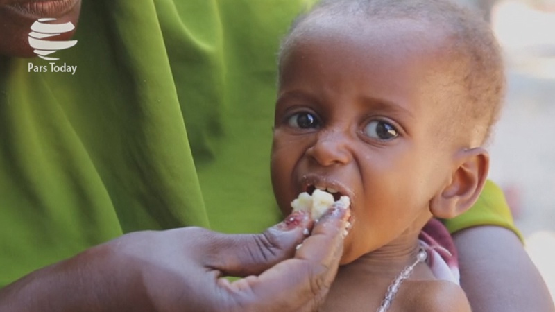 Iranpress: قحطی شدید و سوء تغذیه کودکان در سومالی / ویدئو 