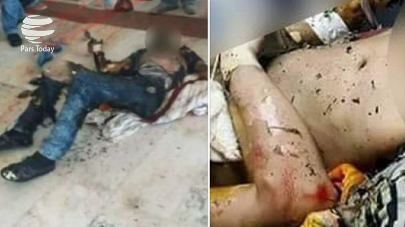 Iranpress: مرگ جوان فلسطینی که در غزه خودسوزی کرده بود