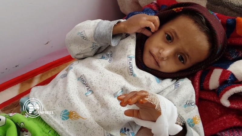 Iranpress: وضعیت وخیم کودکان در بیمارستان السبعین صنعا