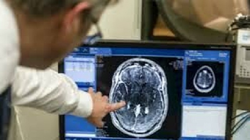 Iranpress: موفقیت محققان ایرانی در ارائه مدل جدید شناخت مکانیزم آسیب مغزی