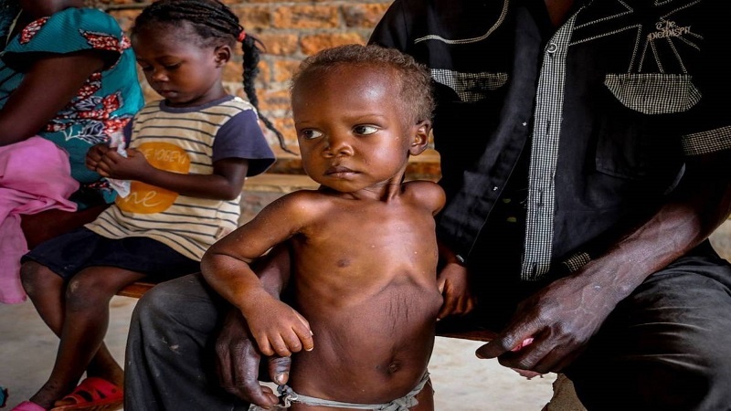 Iranpress:   یک سوم کودکان در سودان دچار سوء تغذیه هستند 